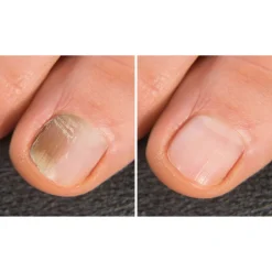 Die moderne Hausfrau Anti-Fuss- und Nagelpilzspray, 100 ml