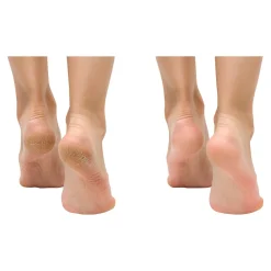 Die moderne Hausfrau Anti-Fuss- und Nagelpilzspray, 100 ml