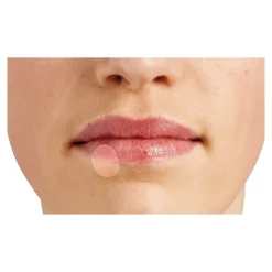 Die moderne Hausfrau Herpes-Patch, 6 Stück