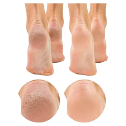 Die moderne Hausfrau Horn-und Nagelhaut-Entferner, 200 ml