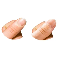 Die moderne Hausfrau Horn-und Nagelhaut-Entferner, 200 ml