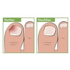 Die moderne Hausfrau Pediküre Eckenfeile